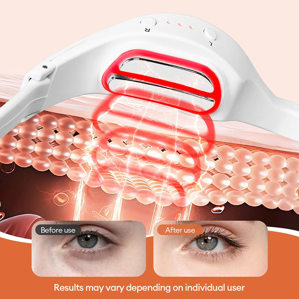 Red Light EMS Eye Massager for Dark Circles