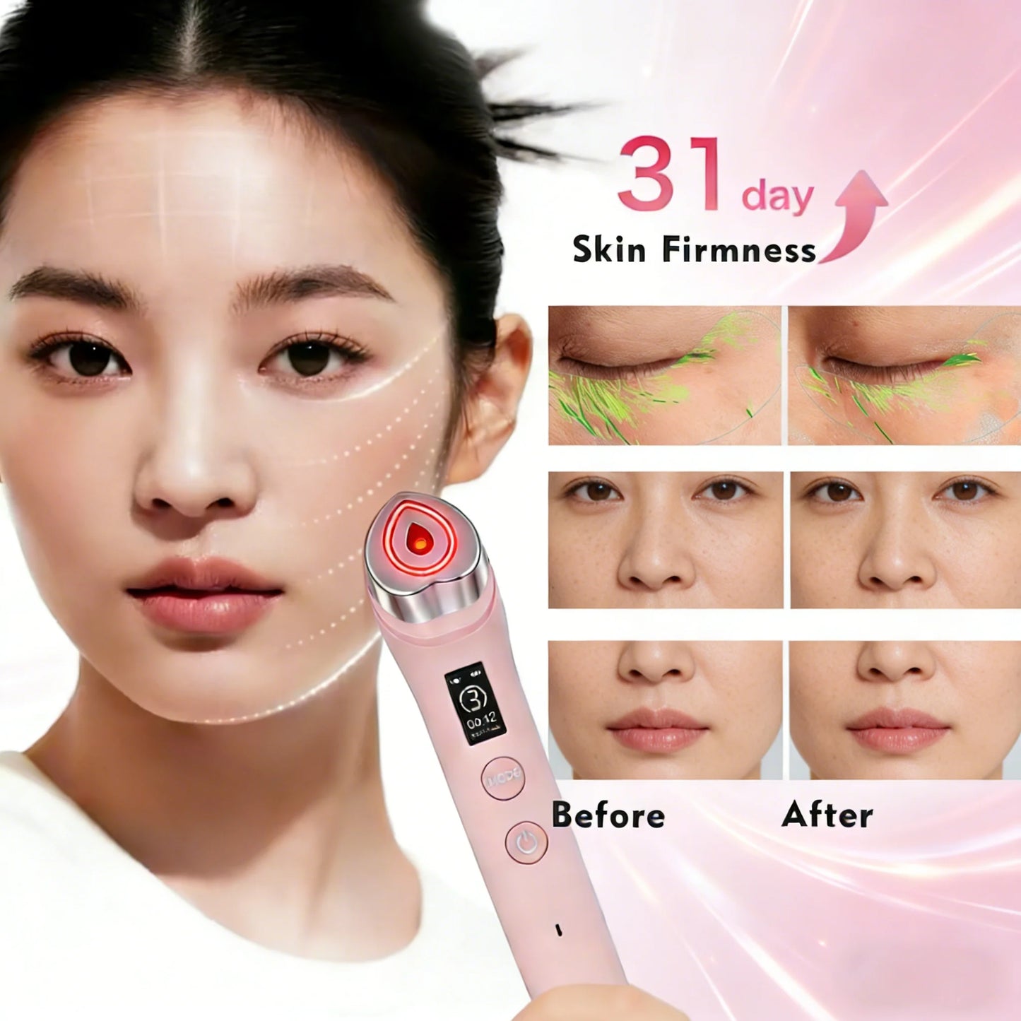 5-in-1 RF Facial Anti-Aging Device