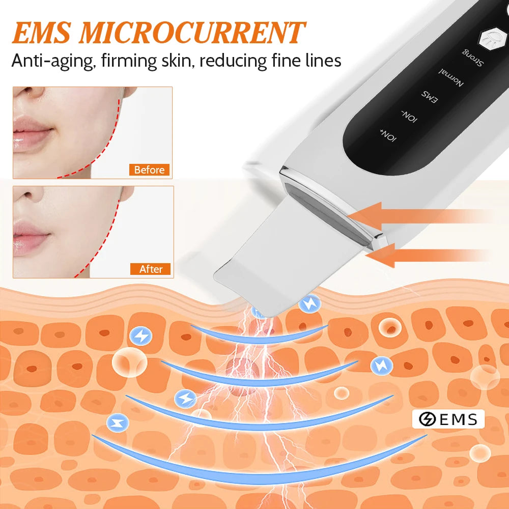 Ultrasonic Skin Spatula: Red & Blue Light Therapy